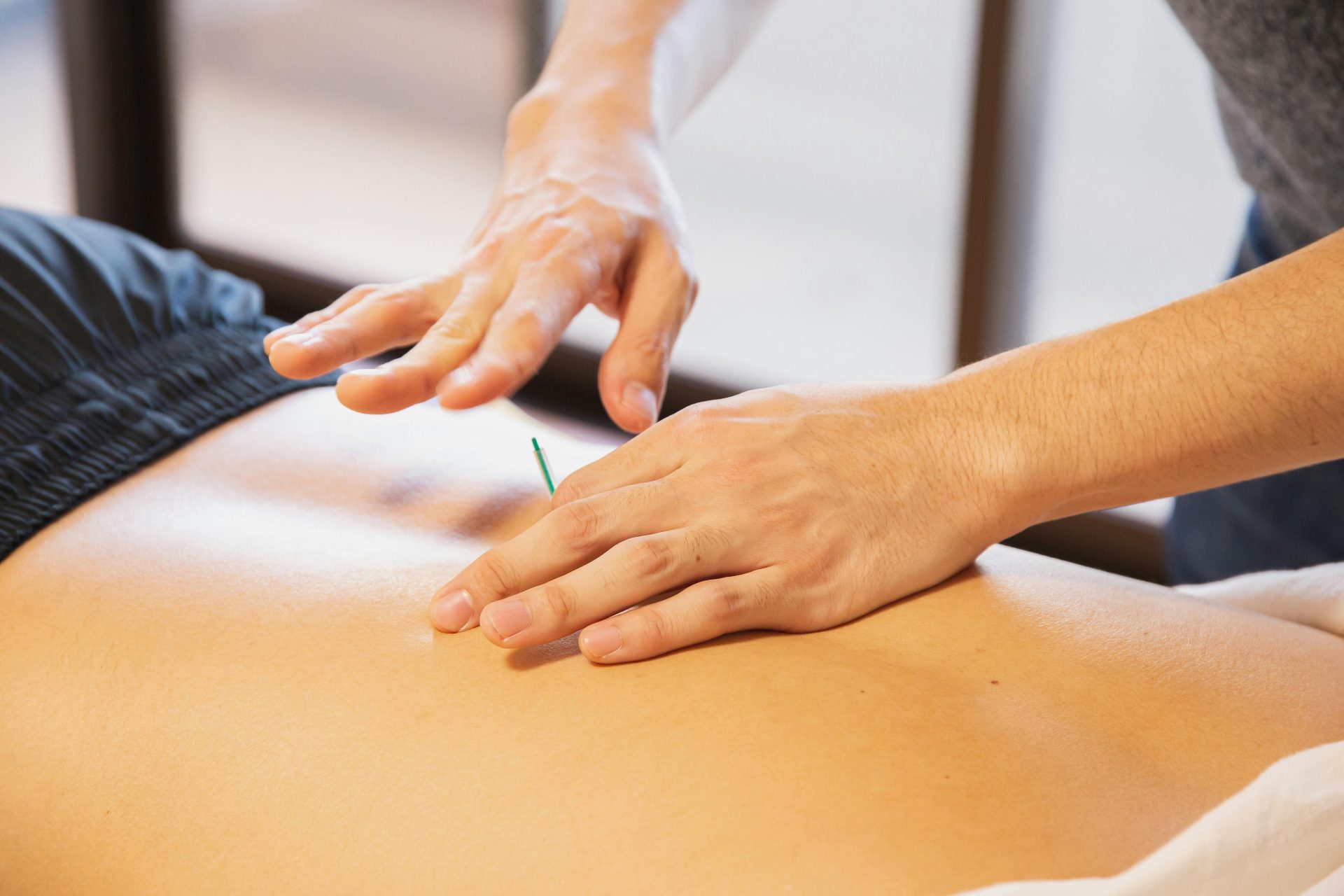 Acupuntura en una espalda